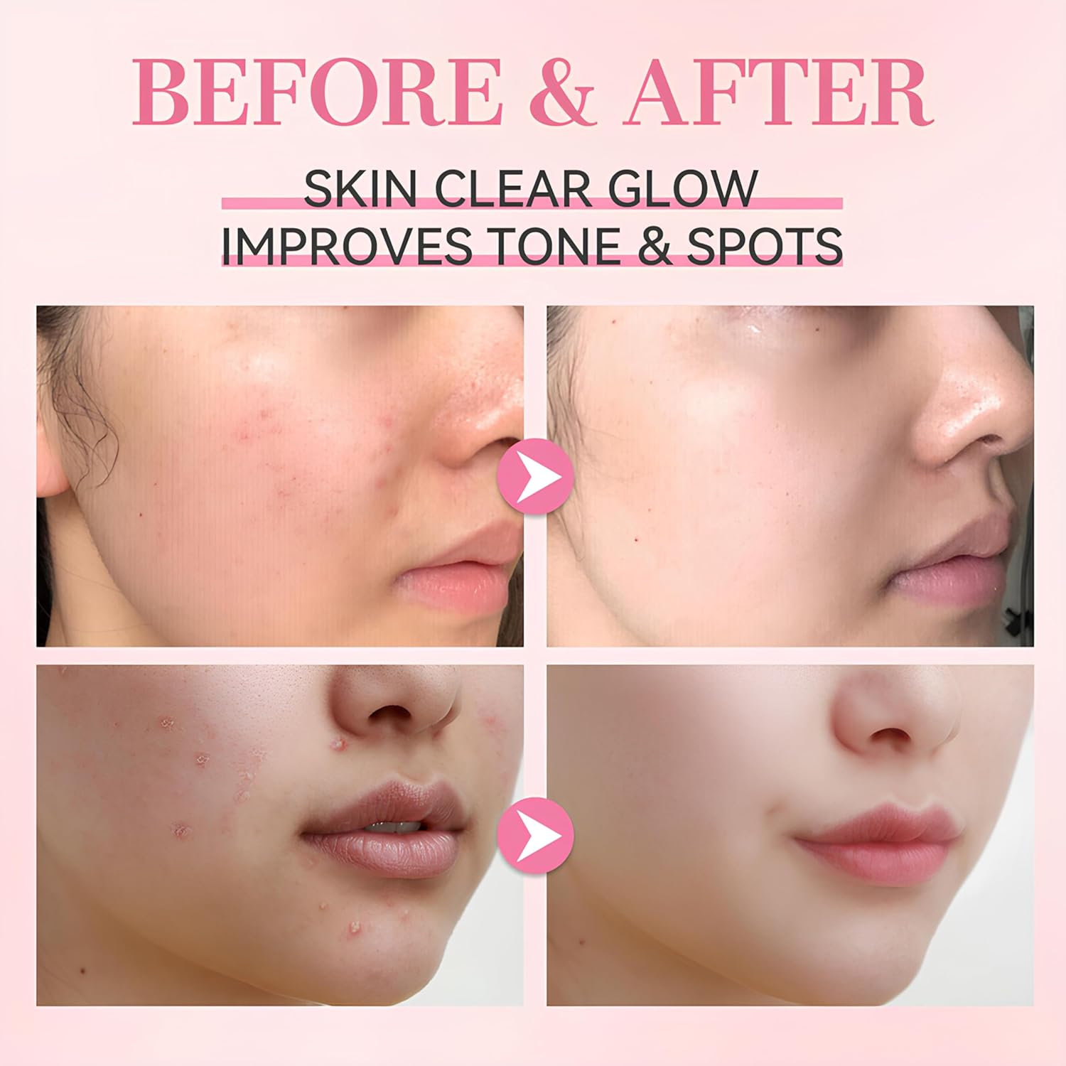 Rose PDRN Pink Peptide Glow Serum, Anti-Aging Face Treatment with 5 Types of Peptide Complex, Dark Spot Correction, Collagen Boosting, 30ml Visit the VibePro Store