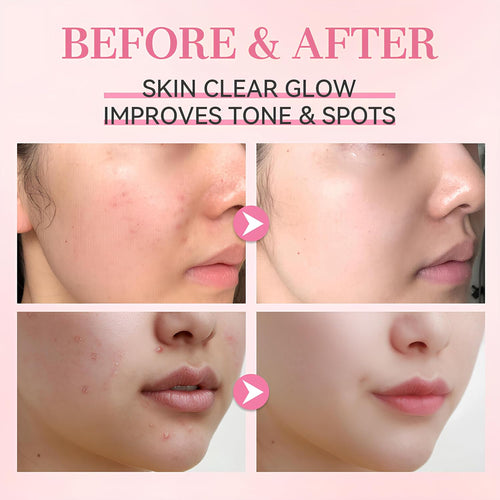 Rose PDRN Pink Peptide Glow Serum, Anti-Aging Face Treatment with 5 Types of Peptide Complex, Dark Spot Correction, Collagen Boosting, 30ml Visit the VibePro Store